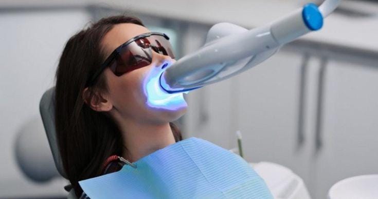 Dr. Monica Gobran & Associates pecializing in Implants, Invisalign, and Sleep Apnea | The Ultimate Guide to Professional Teeth Whitening: Achieve a Brighter Smile Today