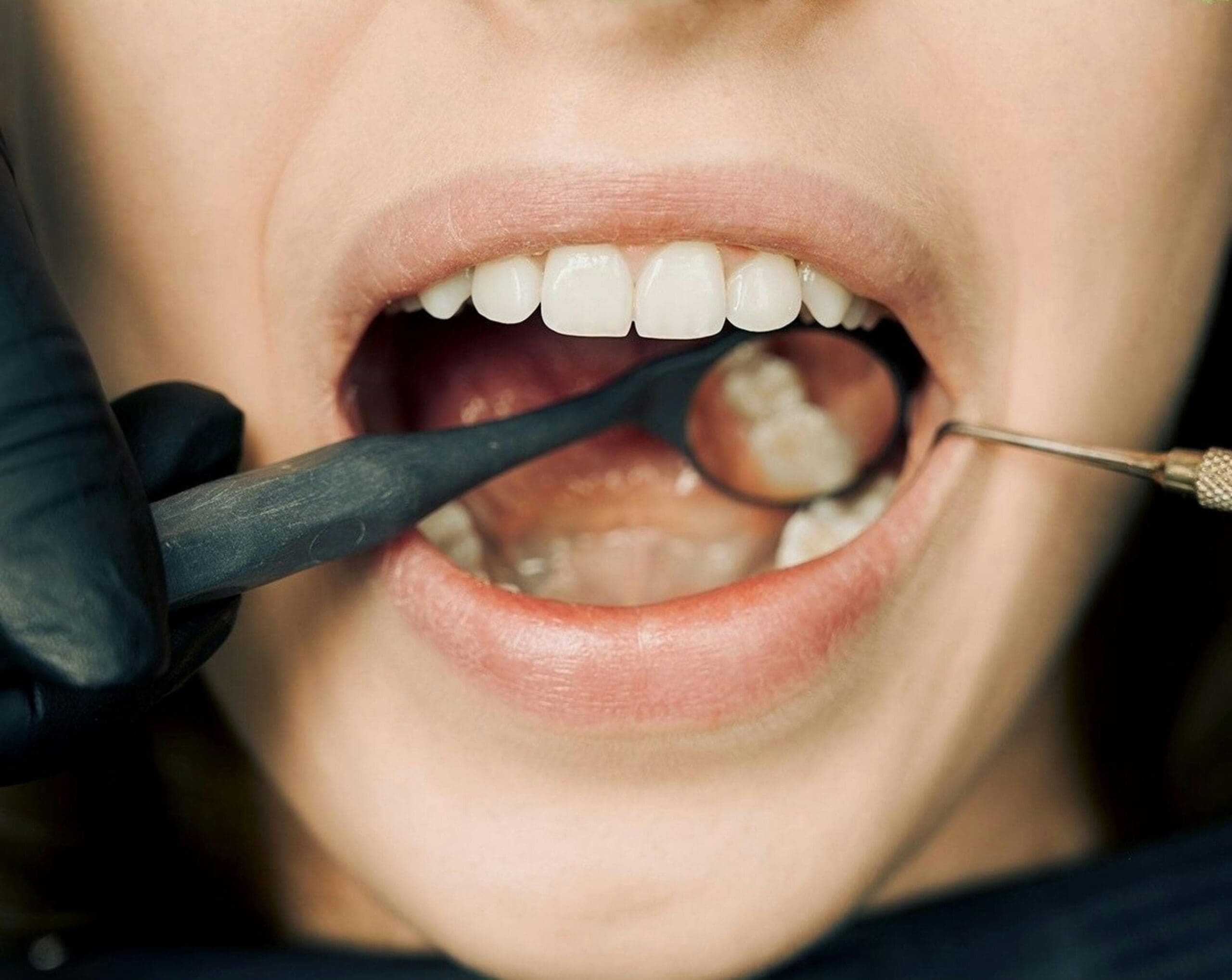 Dr. Monica Gobran & Associates pecializing in Implants, Invisalign, and Sleep Apnea | Understanding Periodontal Treatments: Protecting Your Smile from Gum Disease