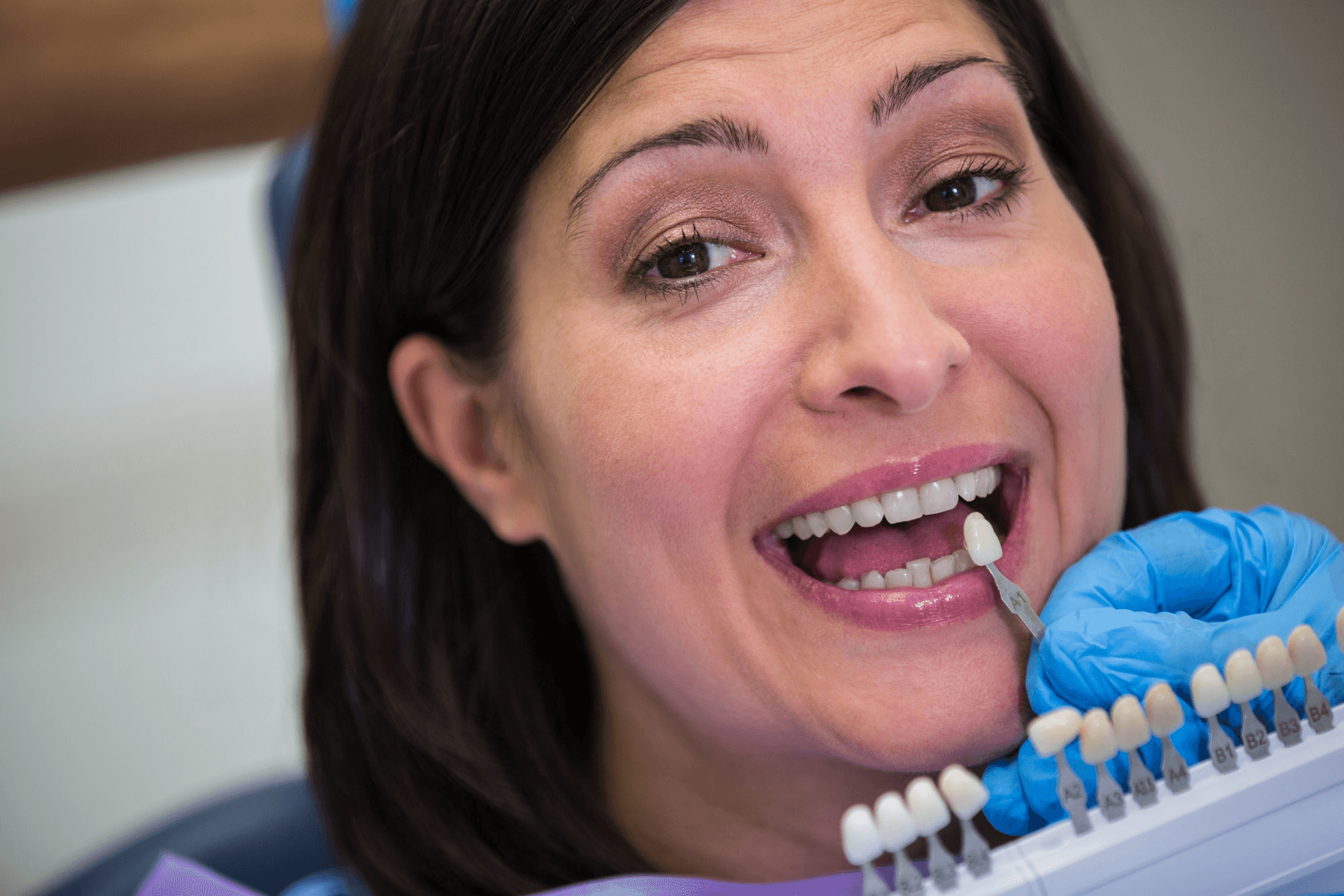 Dr. Monica Gobran & Associates pecializing in Implants, Invisalign, and Sleep Apnea | Porcelain Veneers vs Composite Bonding: Which One is Right for Your Smile?