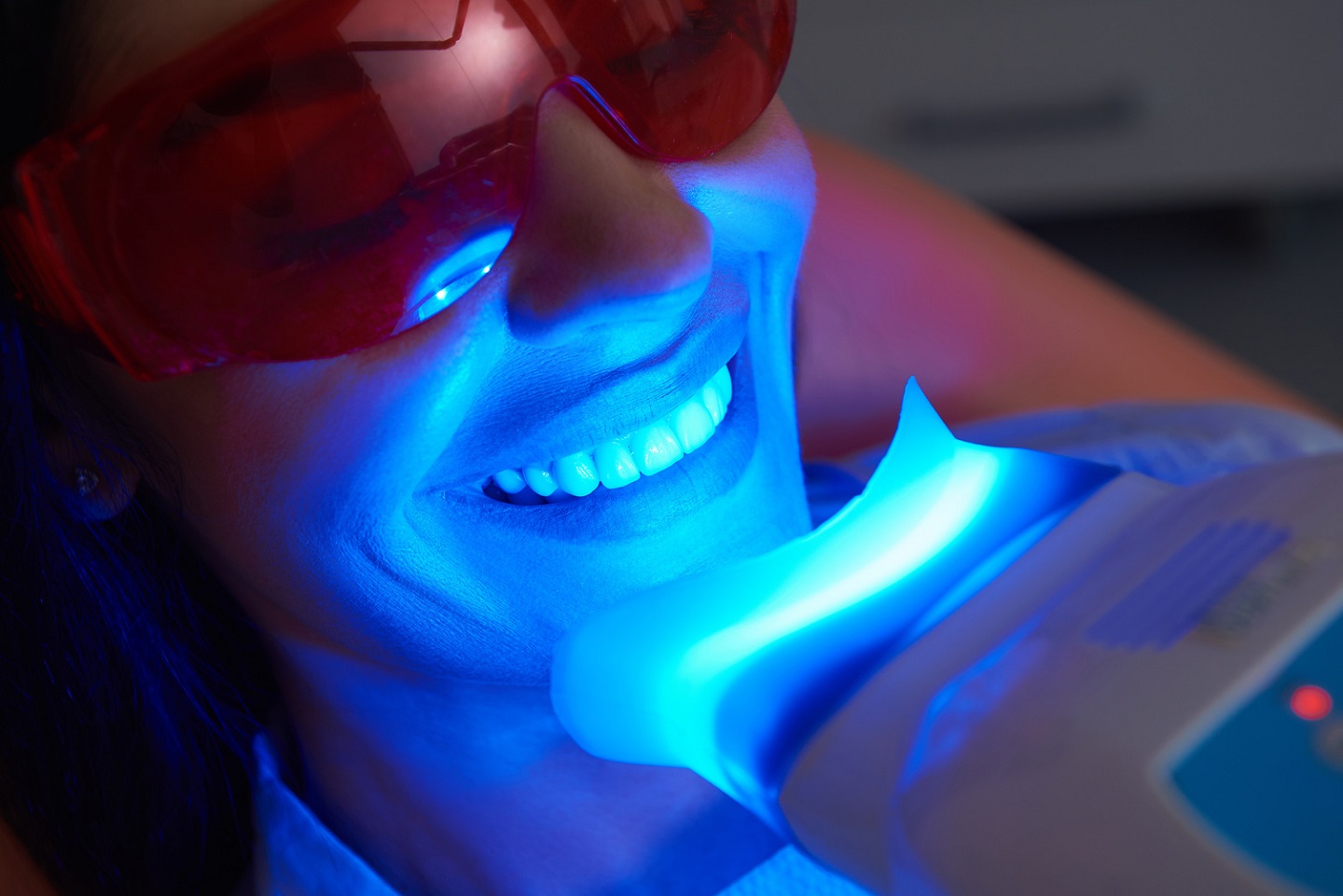 How Long Does Teeth Whitening Actually Last?