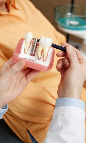 Close-up of a dentist holding tooth model while explaining dental implant surgery to patient at Dr. Monica Gobran & Associates